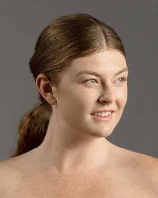 Condition-Based Skin